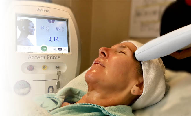 An Accent Prime treatment at Natural Expressions