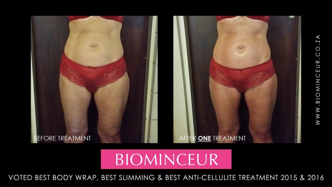 Before and after a BioMinceur body wrap, abdomen and waist