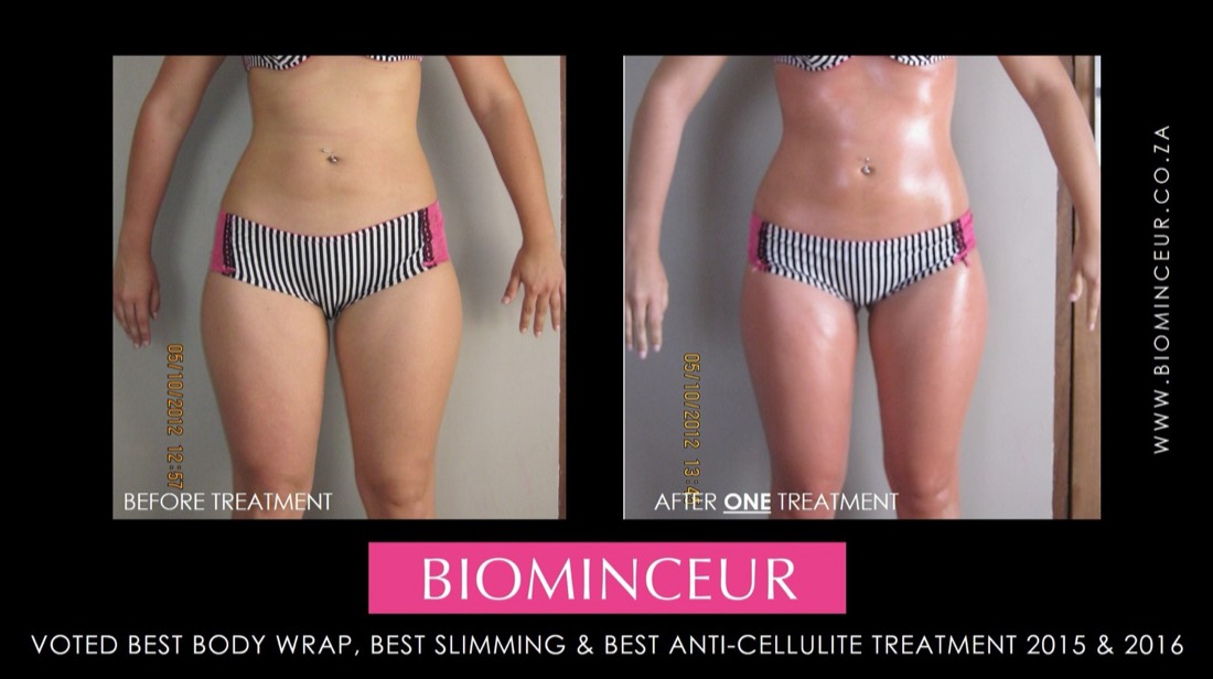 Before and after a BioMinceur body wrap, thighs and hips
