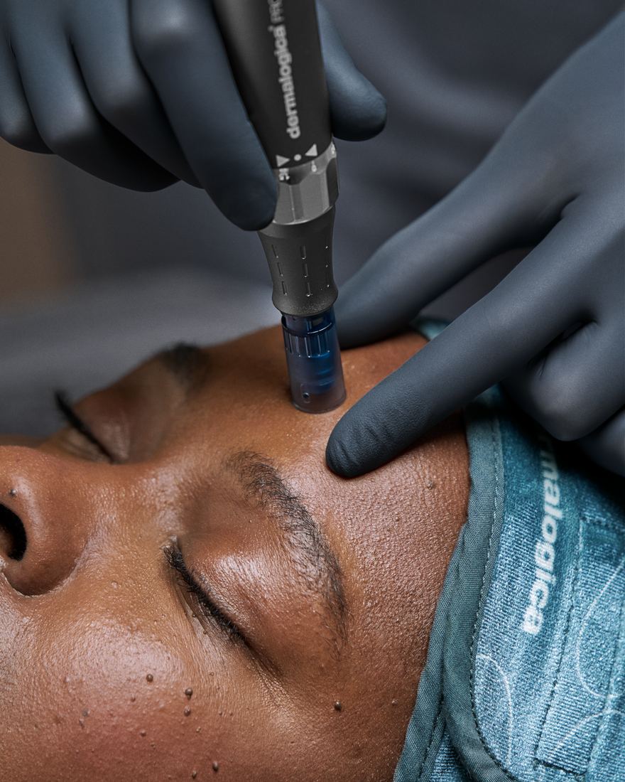 Dermalogica PRO Microneedling