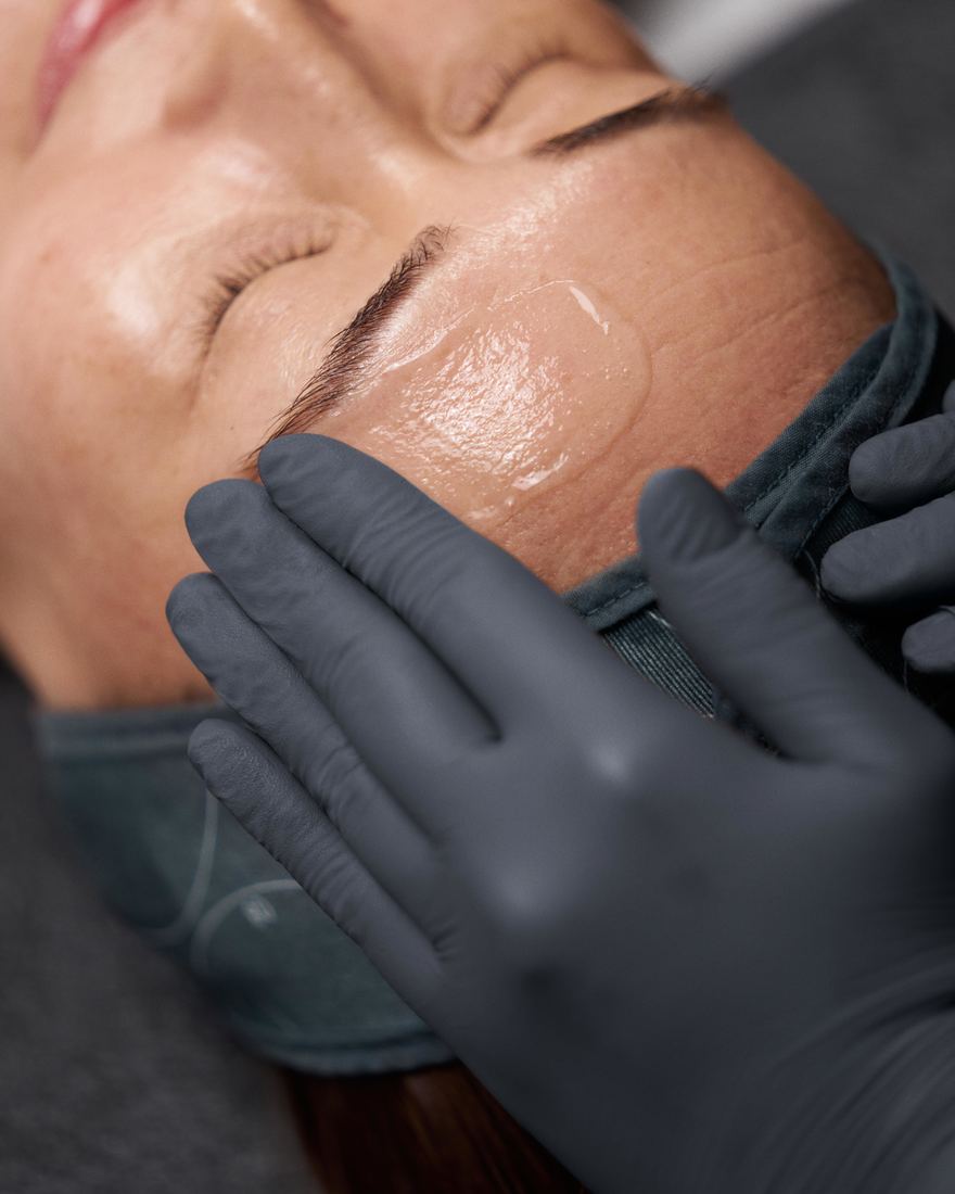 A Dermalogica professional peel