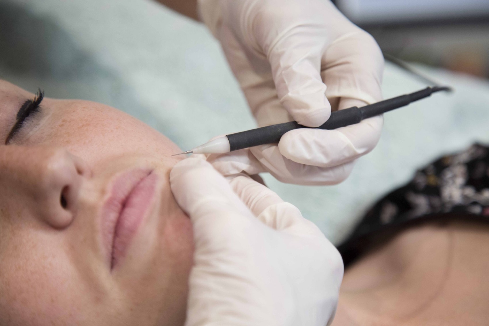 Advanced skin treatment at Natural Expressions