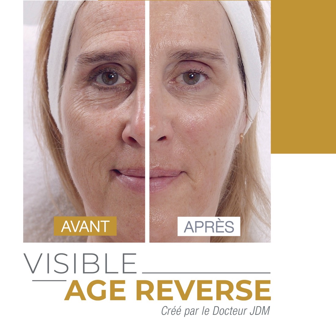 Visible Age Reverse (VAR), a Guinot facial
