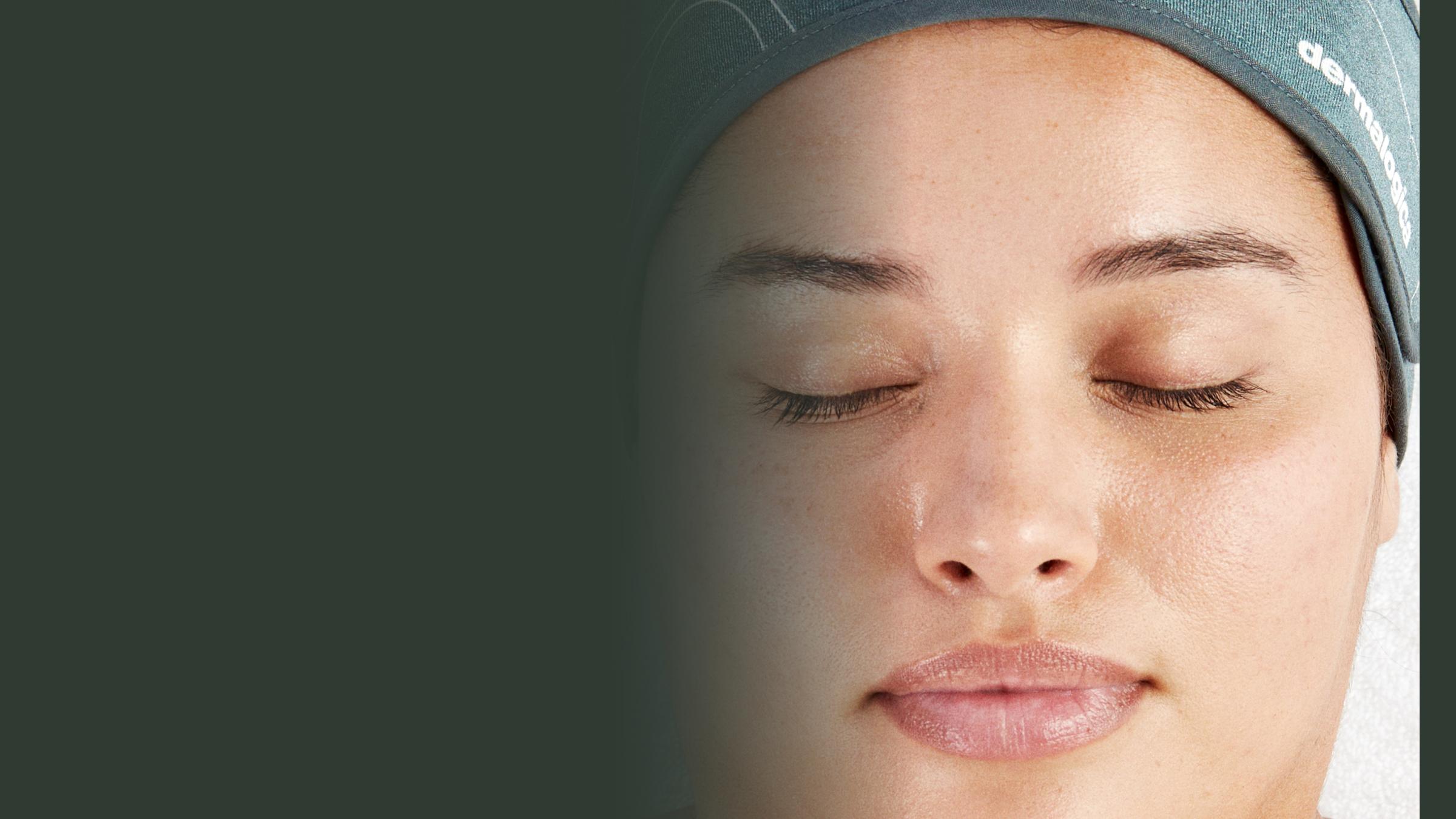 Clean, radiant skin after a treatment at Natural Expressions Aesthetics